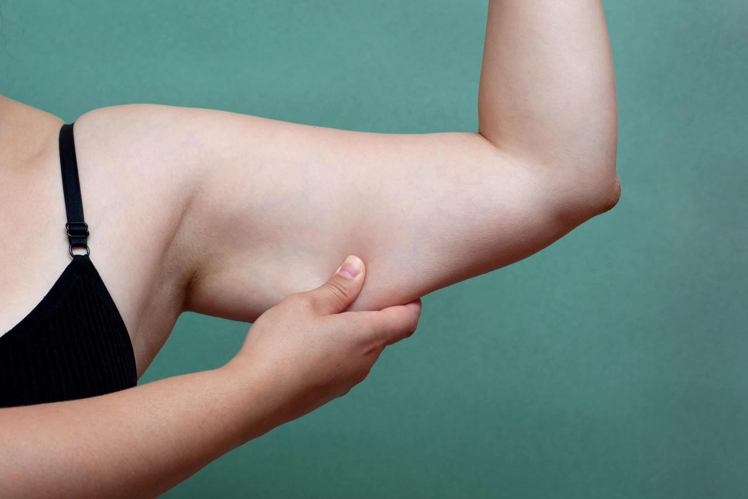 rozwiązanie dla zwiotczałych ramion po 60. roku życia